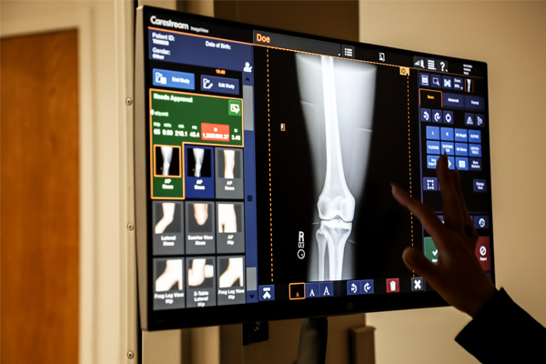 Hand pointing at an x-ray on a computer monitor