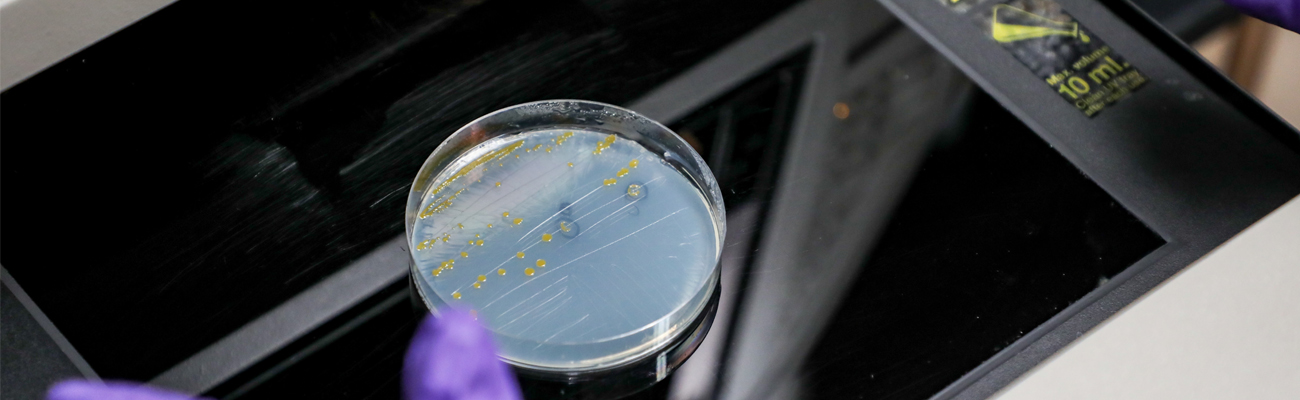 Bacteria growing in a petri dish