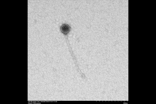 Daggertail Phage taken from Hitachi HT7820 TEM 