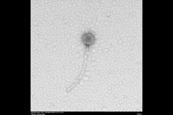 Daka Phage taken from Hitachi HT7820 TEM