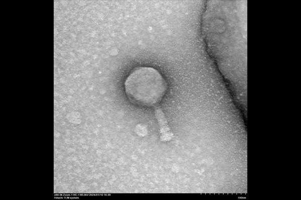 Duckfeet phage taken from Hitachi HT7820 TEM