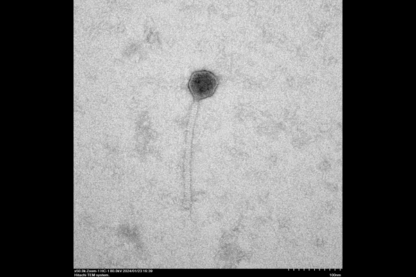 Novi-14 Phage taken from Hitachi HT7820 TEM