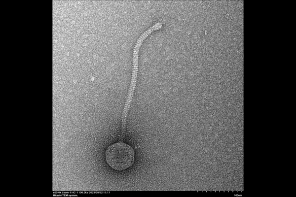 Tooj phage